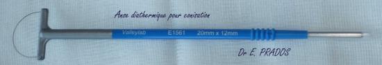 Anse diathermique de conisation